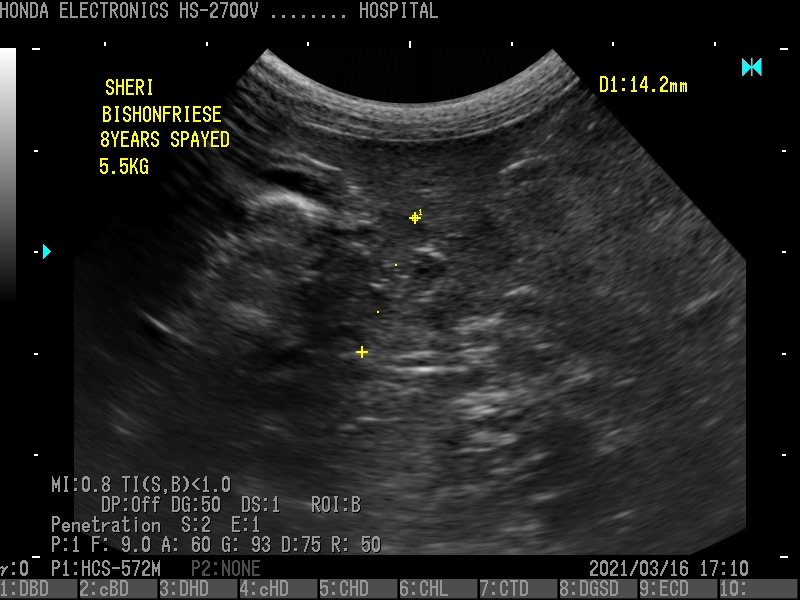 胰腺（Vision Frise，8岁） 探头：HCS-572M H-res：Penetration