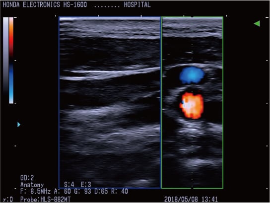 探头：HLS-882MT H-res: Anatomy