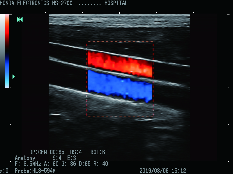 BOX(箱子) 探头：HLS-594M H-res ：Anatomy